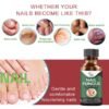 Foot Cure Nail Fungus Solution